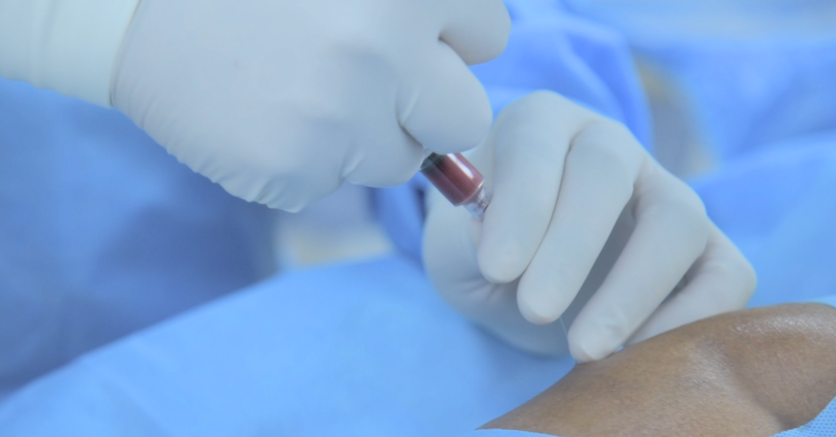 Unlocking the Potential of Hip Stem Cell Injections A Comprehensive Guide