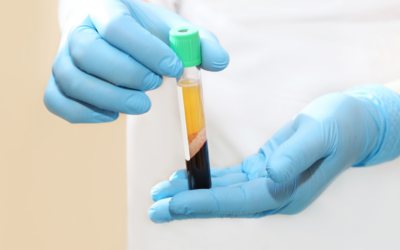 The Ultimate Guide to Platelet Rich Plasma Injections for Arthritis Relief