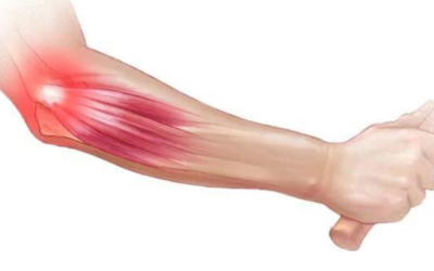 Heal Faster and Get Back on the Court: Tennis Elbow Injury Treatment Explained