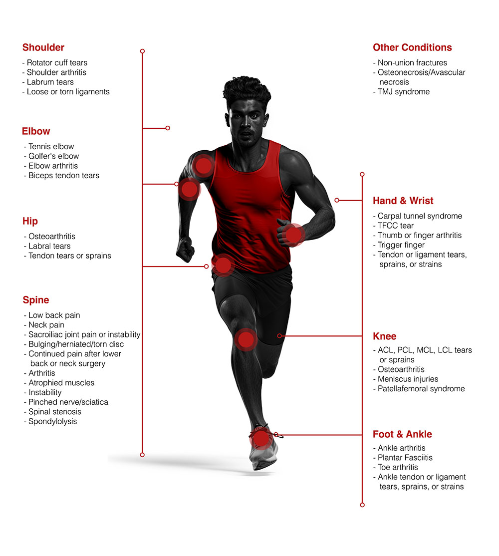 regenorthosport_conditions_treated Common conditions treated with stem cell therapy or platelet-rich plasma.